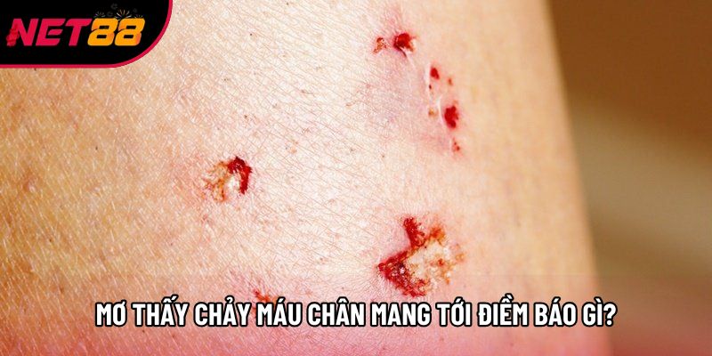 Mơ thấy chảy máu chân mang tới điềm báo gì?